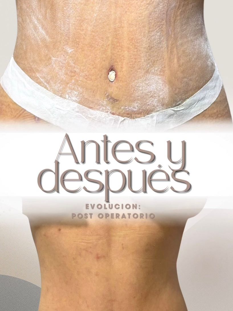 cuidados postoperatorios por manos expertas